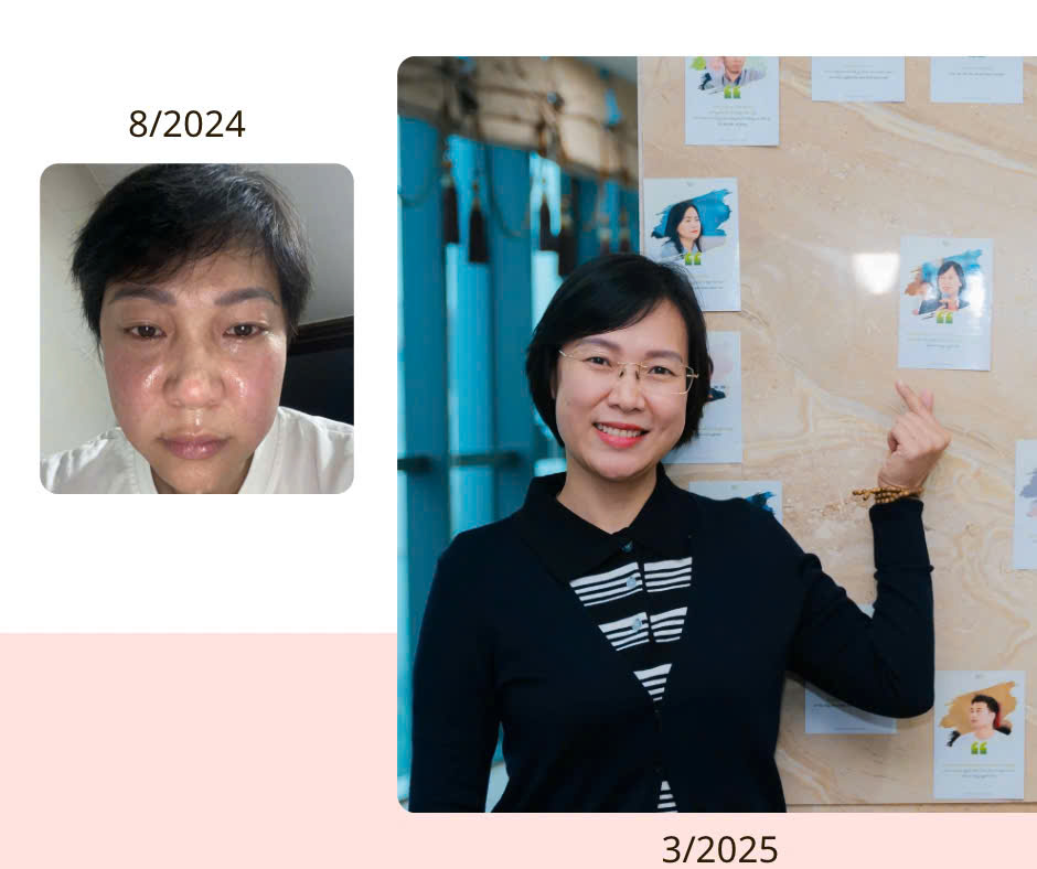 Chị Anh Thư trước và sau hành trình coaching — 8/2024 và 3/2025